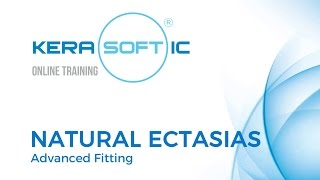 Natural Ectasias  Advanced Fitting [upl. by Dolora329]