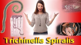 Trichinell Spiralis Complete Overview [upl. by Lock]