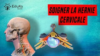 SOIGNER LA HERNIE DISCALE CERVICALE Explications et exercices [upl. by Notled]