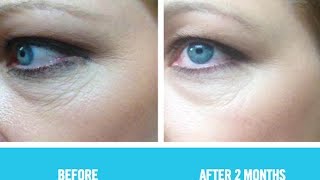 Anti Aging Skin Care  Best Anti Aging Eye Cream to Reduce Wrinkles [upl. by Iborian870]