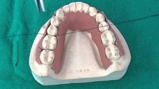 Peridontal Suturing Techniques [upl. by Rikki]