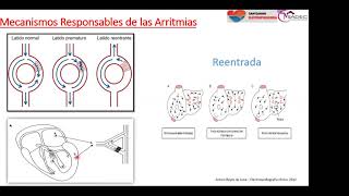 12  Extrasístoles auriculares y ventriculares [upl. by Asirem402]