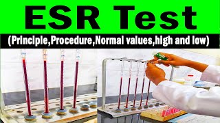 Erythrocyte sedimentation rate  ESR PrincipleProcedureNormal valueshigh and low [upl. by Davie]