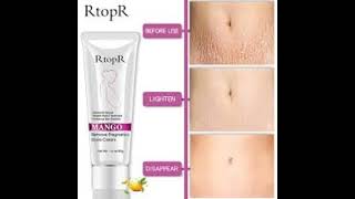 RtopR mango slimming Cream ReviewStretch Marks Remover Cream [upl. by Malin]