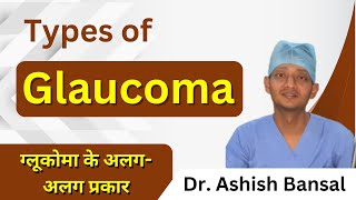 Types of Glaucoma  ग्लूकोमा के अलगअलग प्रकार  Types of Glaucoma in Hindi glaucoma kalamotiya [upl. by Blight]