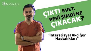 Çıktı Evet Peki Şimdi Ne çıkacak I İnterstisyel Akciğer Hastalıkları [upl. by Katusha]