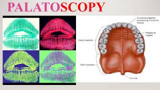 Cheiloscopy and Palatoscopy [upl. by Bough]