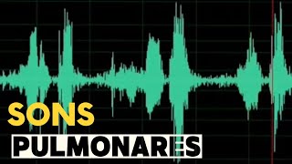 Ausculta pulmonar lung sounds  som normal sibilos estertores creptantes estridor traqueal [upl. by Irby]