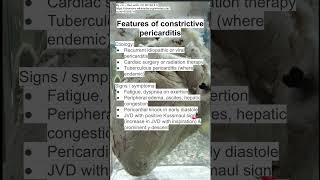 Features of constrictive pericarditis [upl. by Ricard496]