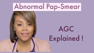 AGC PapSmear Result EXPLAINED  Endometrial Cells [upl. by Ttevi832]