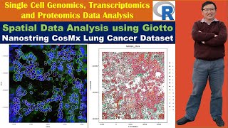 Spatial Data Analysis using Giotto Nanostring CosMx Lung Cancer Dataset [upl. by Regina]