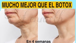 REJUVENECE 10 AÑOS MEJOR que el BOTOX💯Rejuvenece Reafirma Quita MANCHASFLACIDEZ en el CUELLO😱 [upl. by Allene748]