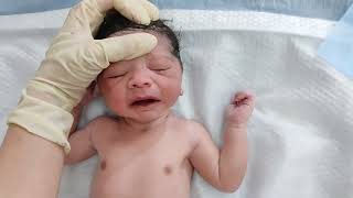 Forceps delivery of newborn baby after birth with first cry looks adorable when dressed up [upl. by Arracahs]