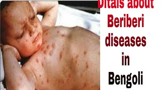 Beriberi রোগ সম্পর্কে বিস্তারিত  child diseases [upl. by Chiles]