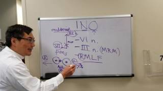 Internuclear Ophthalmoplegia INO [upl. by Shuma]