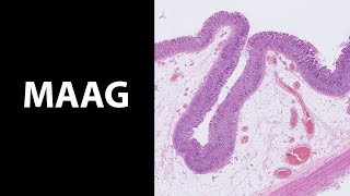 Maag wat een fraai epitheel De histologiemicroscopie van de maag [upl. by Bocoj]