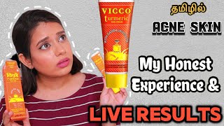 I TRIED VICCO CREAM FOR A WEEK ON ACNE SKIN AND THIS HAPPENED  Vicco Turmeric cream Review in Tamil [upl. by Aisyram669]