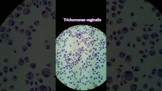 Trichomonas Vaginalis under microscopeparasitology microscopySexuall transmitted parasite [upl. by Zetrac712]