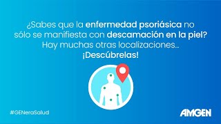 Descubre las diferentes localizaciones de la enfermedad psoriásica [upl. by Orji]