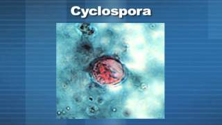 Medical Minute  Cyclospora Parasite [upl. by Ennahtur127]