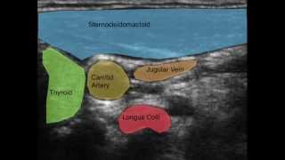 Ultrasound of the Deep Cervical Neck Flexors [upl. by Nanfa]