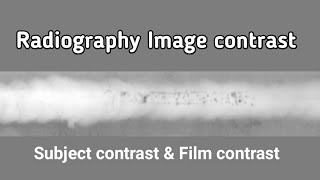 Radiography image contrast ll RT Subject contrast amp Film contrast [upl. by Aleusnoc735]