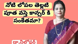 Leukoplakia Telugu Oral Cancer Precancerous Lesions Leukoplakia Symptoms Leukoplakia Causes [upl. by Ttennej]