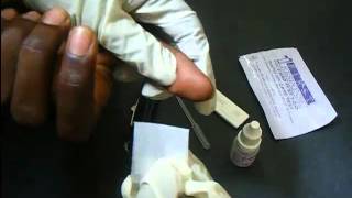 HIV Antibody Test Using A Rapid HIV Card [upl. by Aronaele]