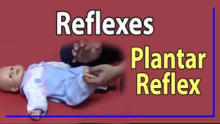 22 Plantar Reflex [upl. by Eileek266]