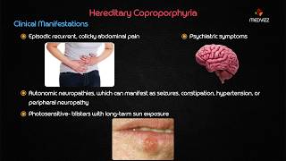 Hereditary Coproporphyria  Biochemistry usmle step 1 webinar lecture [upl. by Eenram959]