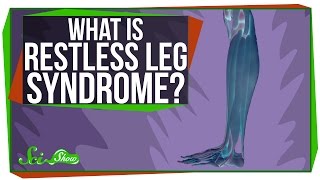 What is Restless Leg Syndrome [upl. by Ycnan239]