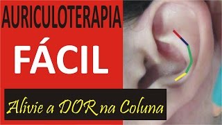 Auriculoterapia Nas Algias Vertebrais Aprenda Grátis Auriculoterapia [upl. by Alikat222]