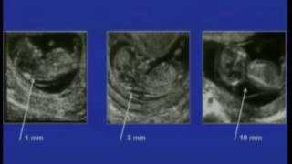 AIUM Guidelines for Obstetrical Ultrasound [upl. by Aurthur]