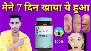 hk vitals vitamin e capsules uses benefits  hk vitals vitamin e capsule honest reviewVitamin e [upl. by Irol]