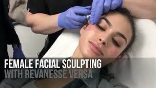 Live Female Facial Sculpting with Revanesse Versa Filler by Dr Jason Emer  Before amp After Result [upl. by Lambard]