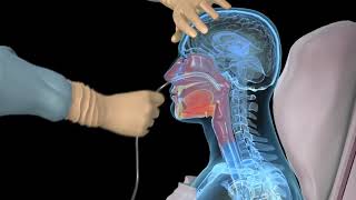 How to insert a nasogastric tube for NG intubation  3d animation [upl. by Nanon]