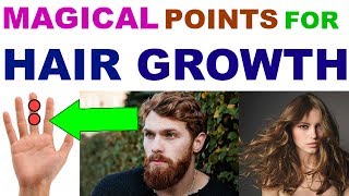 Sujok Therapy For Hair GrowthAcupressure For Hair RegainAcupressure Points For Hair Growth Hindi [upl. by Shani]