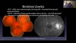 Update on White Spot Syndromes [upl. by Alonso]