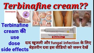 Terbinafine hydrochloride cream Usesside effects directions Fungal infection treatment in Hindi [upl. by Gnak397]