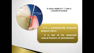 Perio 501  Lec 1  Periodontal pocket [upl. by Ekihc]