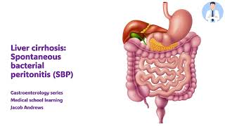 SPONTANEOUS BACTERIAL PERITONITIS [upl. by Colton553]