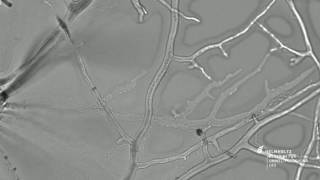 Bacteria on the Fungal Highway Pseudomonas putida moving along hyphae of Cunninghamella elegans [upl. by Marcin206]