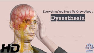 Dysesthesia 101 A Comprehensive Guide to this Mysterious Condition [upl. by Cioffred579]