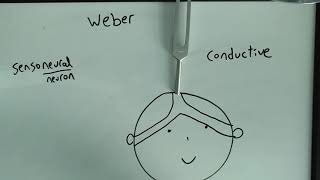 Weber Test made easy SensoneuralConductive hearing loss USMLE [upl. by Monty59]