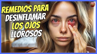 🔴 REMEDIOS CASEROS PARA DESINFLAMAR LOS OJOS LLOROSOS 🔴 [upl. by Padraig]