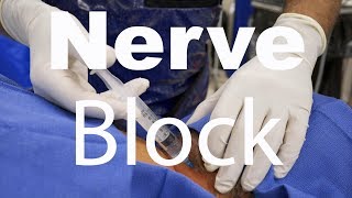 Behind The Scenes Greater Occipital Nerve Block [upl. by Daniella]