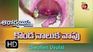 Aarogyamastu  Swollen Uvula  6th January 2017  ఆరోగ్యమస్తు [upl. by Hazeghi]