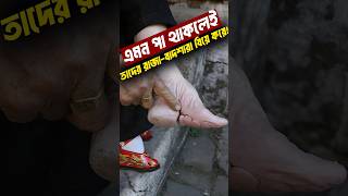 চীনের মানুষের পা এমন কেন Foot Binding [upl. by Jamaal898]