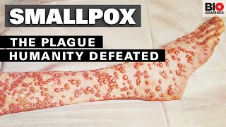 Smallpox The Plague That Humanity Defeated [upl. by Sianna]