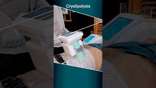 Cryolipolysis shorts viral health [upl. by Filomena]